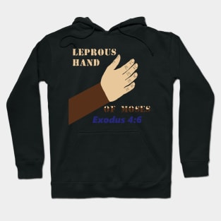 Leprous Hand of Black Moses - Exodus 4:6 - Hand in Bosom - Hebrew Israelites - Jews are Black Hoodie